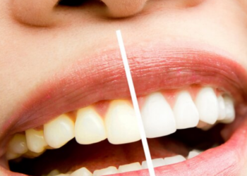 how to whiten teeth with lemon