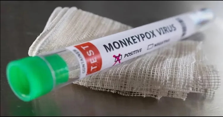 WHO declare Monkeypox virus global emergency