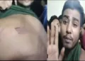 Bangladeshi Hindu brutally beaten by Army