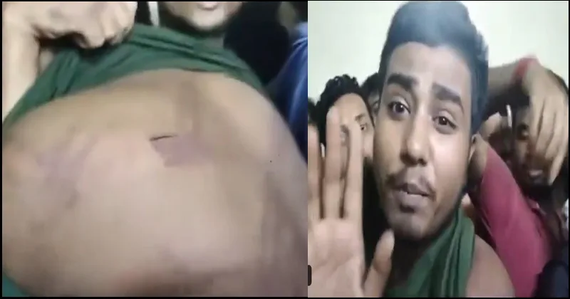 Bangladeshi Hindu brutally beaten by Army