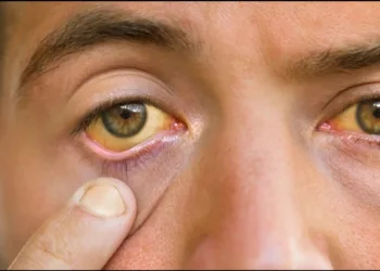India becomes trachoma free country