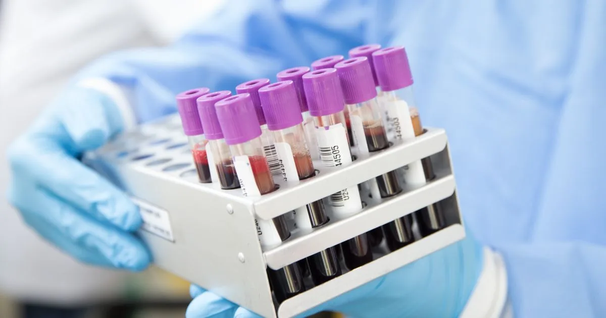 अगर Blood Sample की जगह Tears Sample का करें इस्तेमाल तो क्या होगा? यहां जानिए पूरी डीटेल