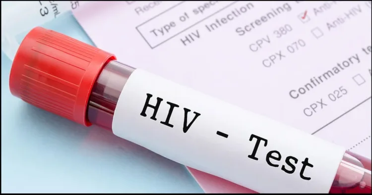 Delhi Man HIV syndrome