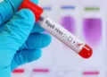 Nipah virus symptoms