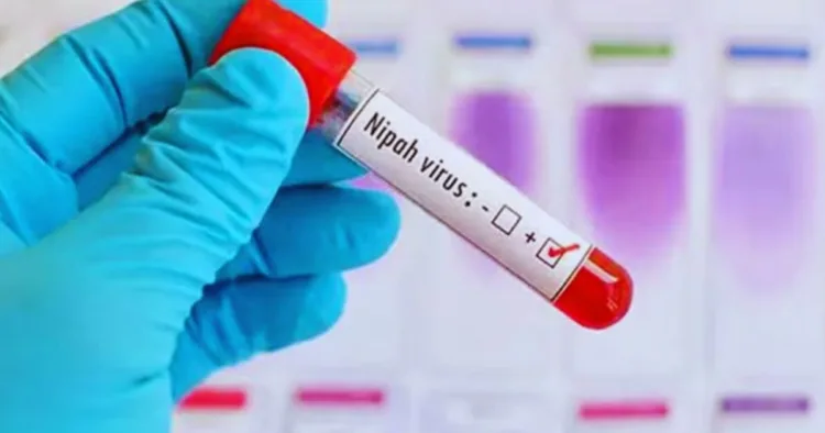 Nipah virus symptoms