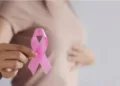 breast cancer