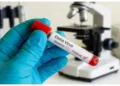 Ebola outbreaks india Africa summit cancelled