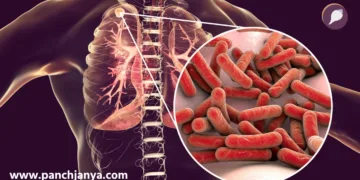 Punjab Haryana TB Cases Increasing Report