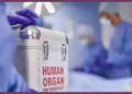 SGPGI Lucknow Doctors Organ Donation Success Story